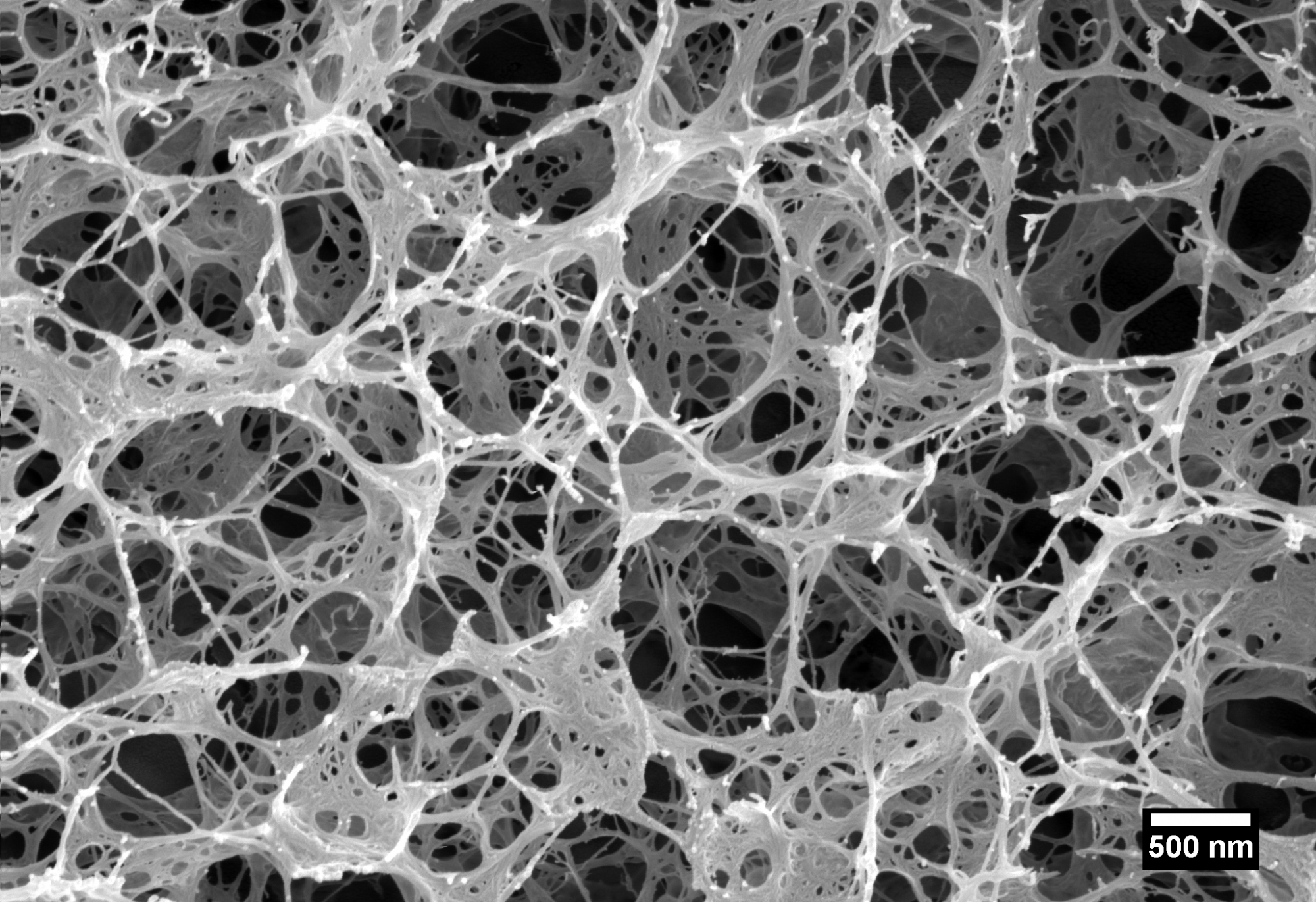 Cryo-SEM of a polymer network revealed after sublimation of ice.