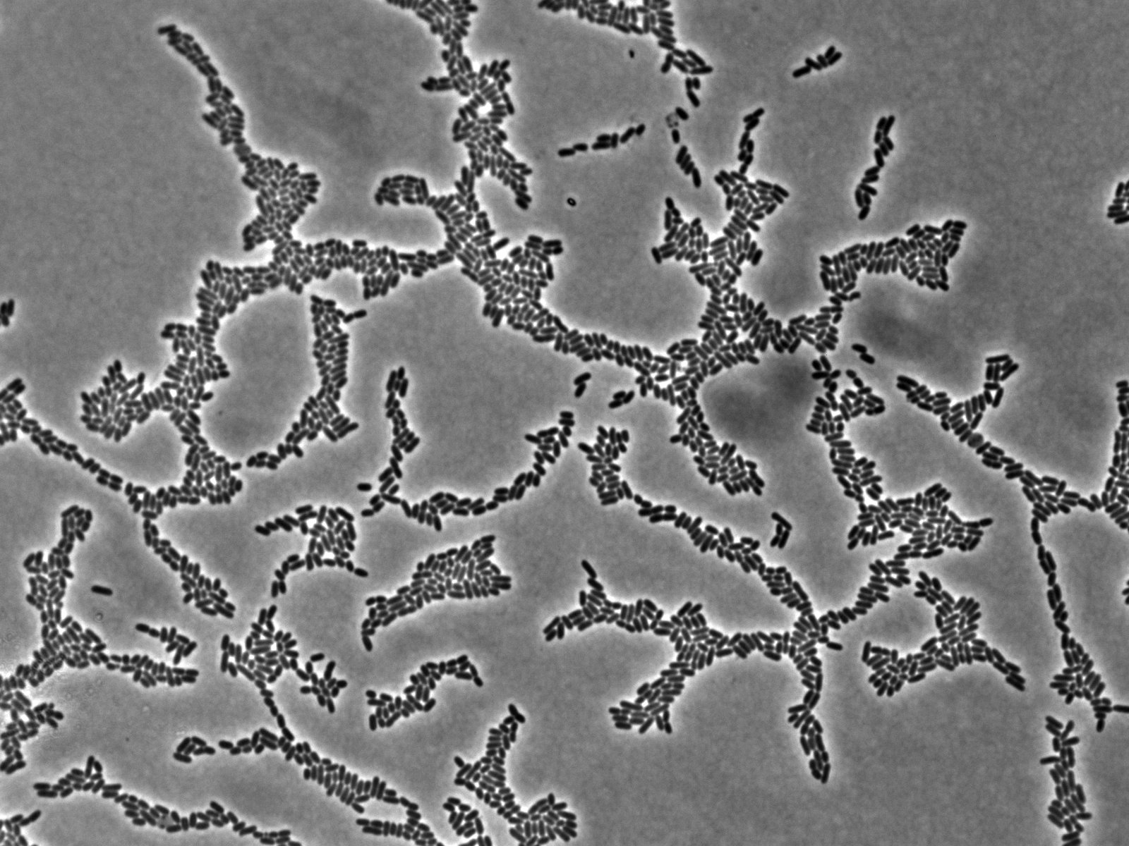 Pseudomonas aeruginosa bacteria colonising an agar surface.