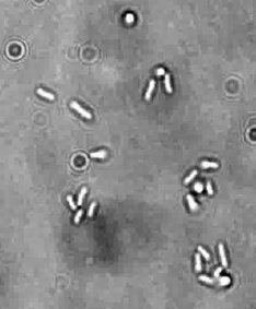 The team will investigate how this kind of initial clustering affects the final structure of the biofilm. Image from the lab of Dr Vernita Gordon, University of Texas.